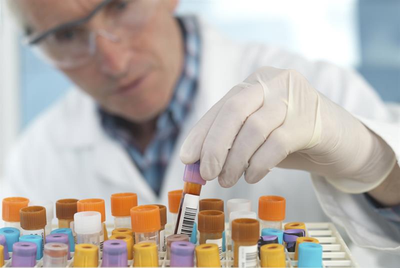 Laboratory capacity affected (Photo: Westend61/Getty Images)