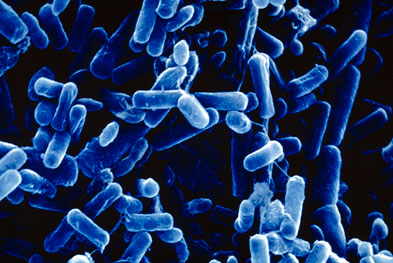 The primary cause of death in cystic fibrosis is respiratory failure precipitated by chronic pulmonary infection caused by Pseudomonas aeruginosa (pictured) | SCIENCE PHOTO LIBRARY