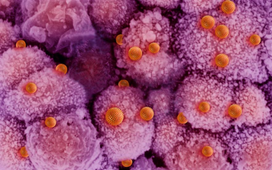There is now a substantial likelihood that people presenting with influenza-like illness are infected with the influenza virus. | SCIENCE PHOTO LIBRARY