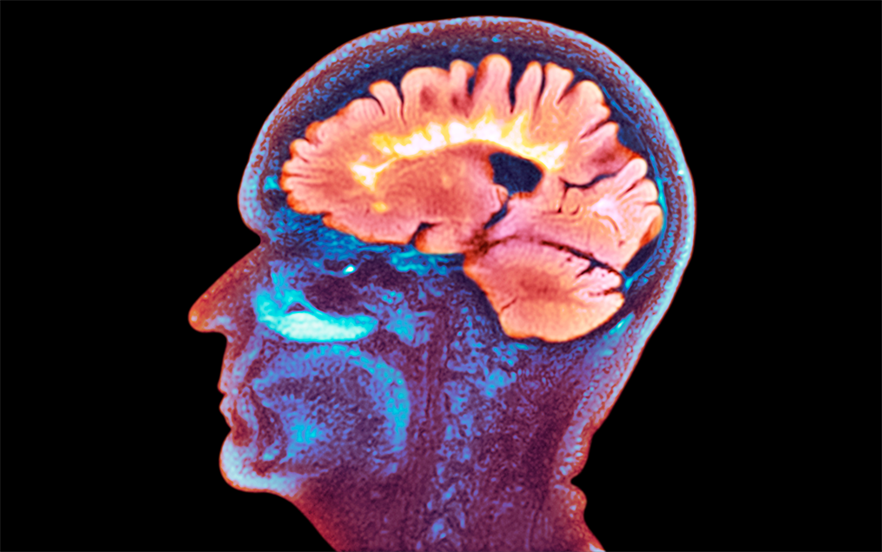 The recommended cumulative dose of Mavenclad is 3.5mg/kg over 2 years, administered as 1 or 2 tablets daily for 4 or 5 days at the start of month 1 and repeated at the start of month 2 of each treatment year. | SCIENCE PHOTO LIBRARY