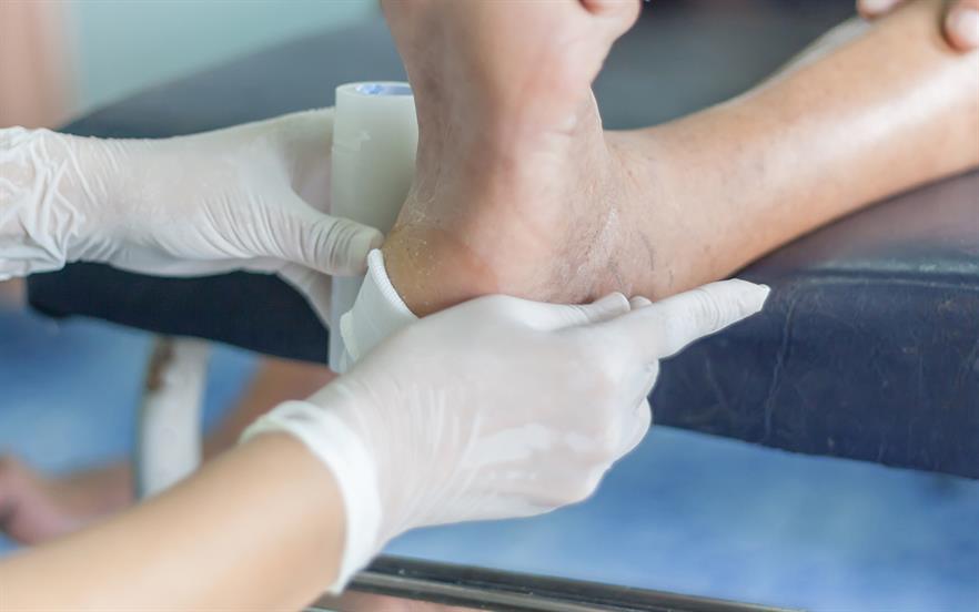In diabetes, all foot wounds are likely to be colonised with bacteria. | GETTY IMAGES
