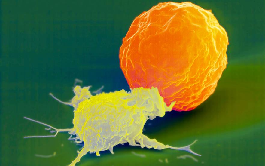 Elotuzumab new immunestimulating myeloma treatment MIMS online