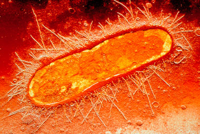 Urinary tract infections, including those caused by E. coli (pictured), can be treated with nitrofurantoin provided the patient has no significant degree of renal impairment | SCIENCE PHOTO LIBRARY