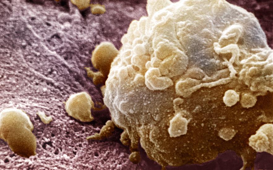 Prior to treatment with trametinib, patients must be tested to confirm their tumour has a BRAF V600 mutation. | SCIENCE PHOTO LIBRARY