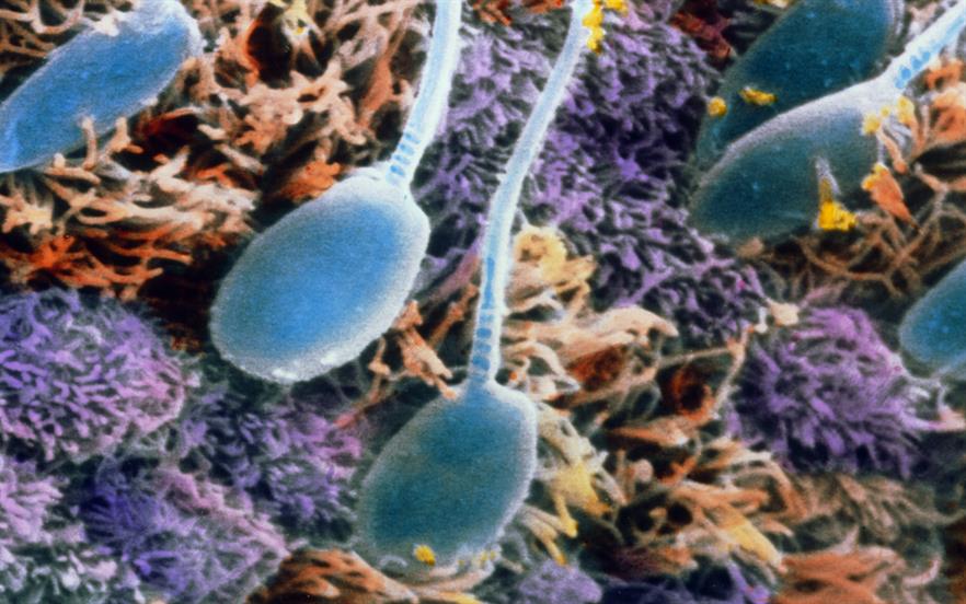 The presence of levonorgestrel in the endometrium causes thickening of cervical mucus making it impenetrable to sperm. | PROFESSORS P.M. MOTTA & J. VAN BLERKOM/SCIENCE PHOTO LIBRARY