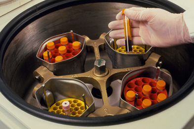 The patient's blood is centrifuged in preparation for treatment (Photograph: Chris Priest/Science Photo Library)