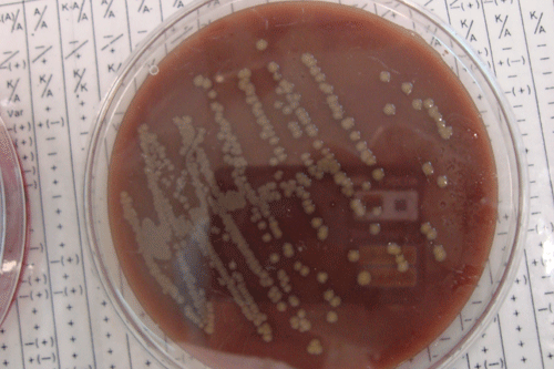 FPC slams lack of industry consultation over E. Coli - image: Morguefile