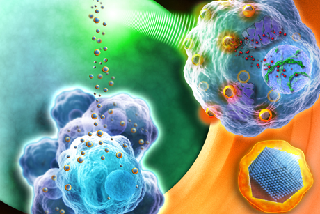Treatment development: NanoXray particles in cancer cells (Credit: Nanobiotix)
