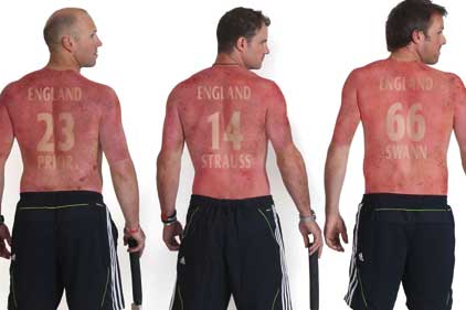 Raising awareness of sun damage: England cricketers