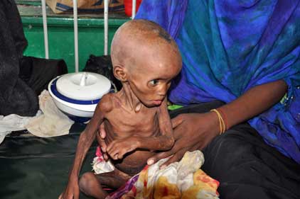 Graphic: charities use images of malnourished children