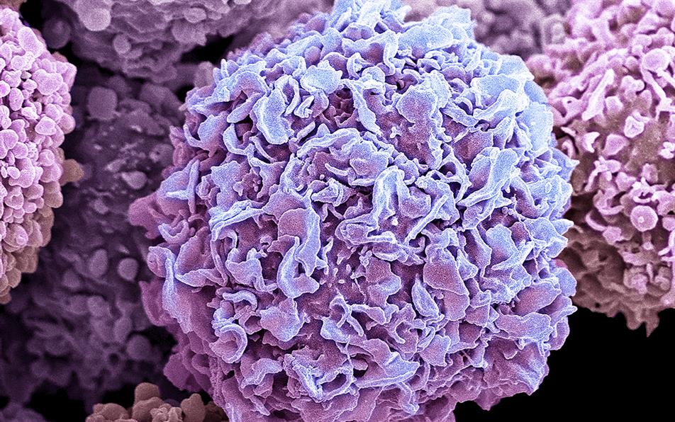 NICE approves breast cancer drug as first women's health strategy