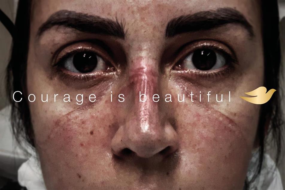 Dove's "Courage is beautiful": won two golds