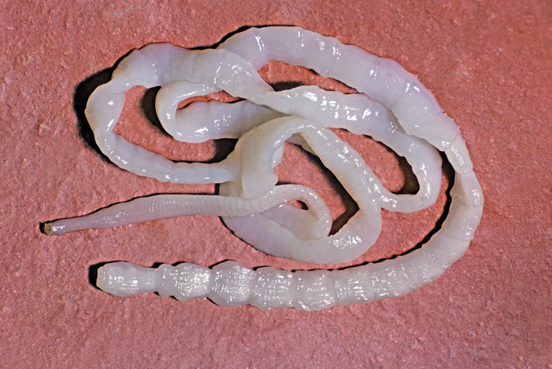Tapeworm Infestation In A Returned Traveller GPonline